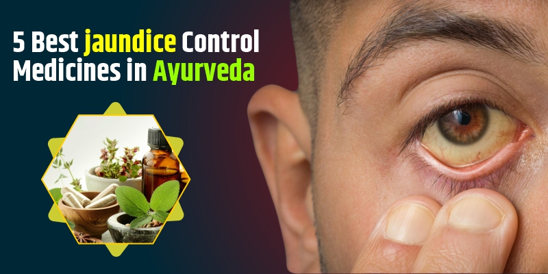 jaundice-control-medicines-in-ayurveda